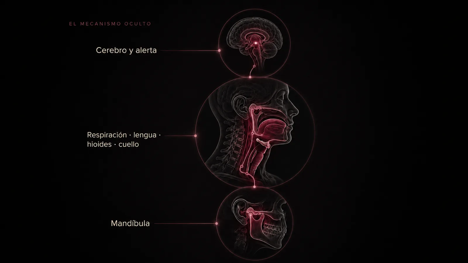 Representación del mecanismo global del bruxismo desde cerebro y alerta hasta mandíbula.